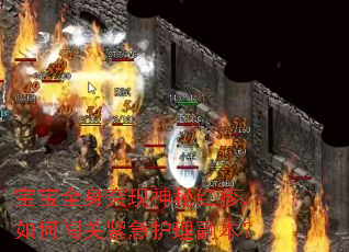 宝宝全身突现神秘红疹,如何闯关紧急护理副本? 宝宝全身突现神秘红疹,如何闯关紧急护理副本?